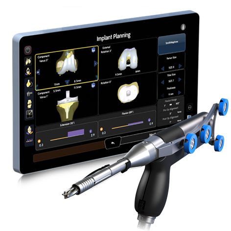 Smith+Nephew CORI Robotic Surgical System — used at Hinduja Healthcare Surgical, Khar